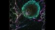 FV3000: 미세유체 소자에 구성된 혈관 및 종양 스페로이드 내 형광 방울의 흐름