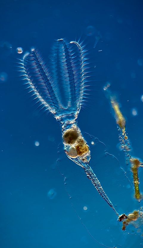 显微镜下的花环轮虫(Stephanoceros fimbriatus)