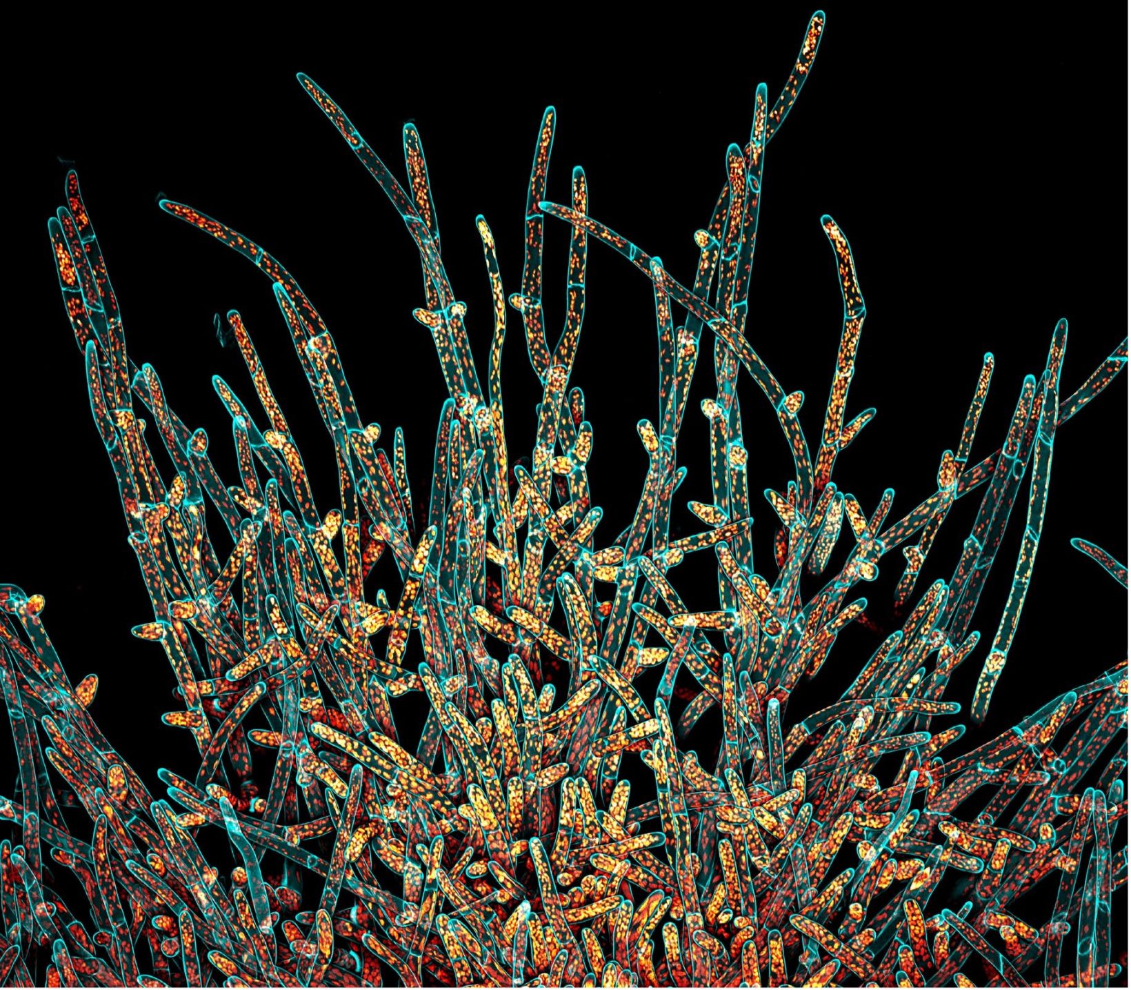 IOTY 2021 Americas winning image of moss Physcomitrium patens protonemal cells 