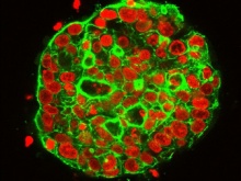 3 Ways Microscope Imaging Advances Organoid Research