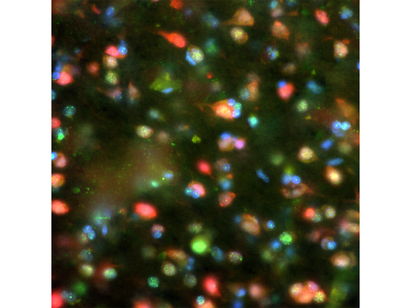 Image d’application de la colocalisation de NeuN et γ-H2AX dans un cerveau de singe