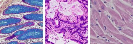 Brightfield images of a colon, HE stained mouse lung, and HE stained mouse heart section