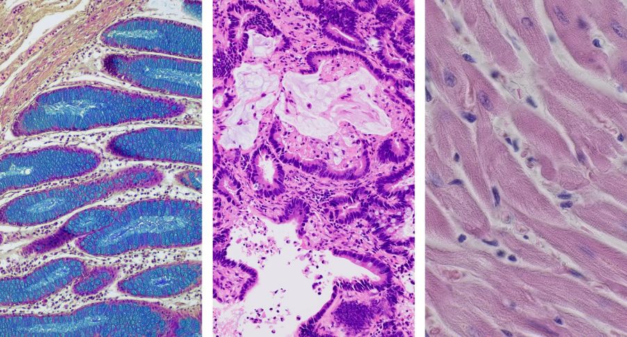 Brightfield images of a colon, HE stained mouse lung, and HE stained mouse heart section